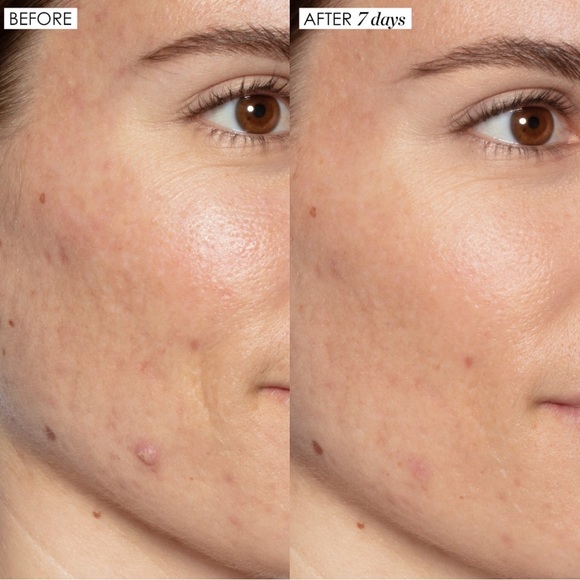 Sunday Riley Good Genes Lactic Acid Treatment 30ml - Picture 3 of 3